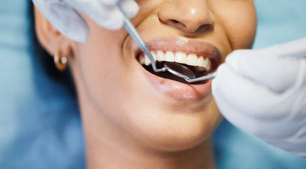 Professional Emergency Dentist in CA