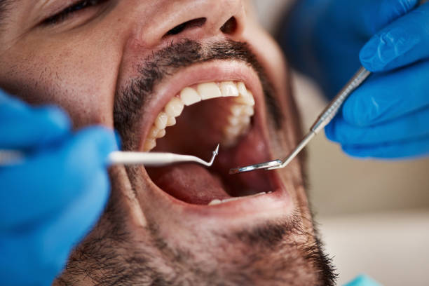 Best Dentist for Severe Toothache  in Rio Dell, CA